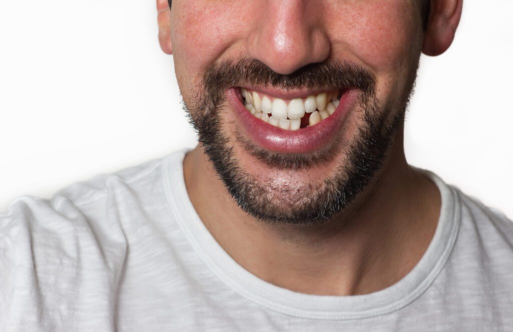 Seaside Family & Cosmetic Dentistry offers several treatments for missing teeth in Hampstead, NC