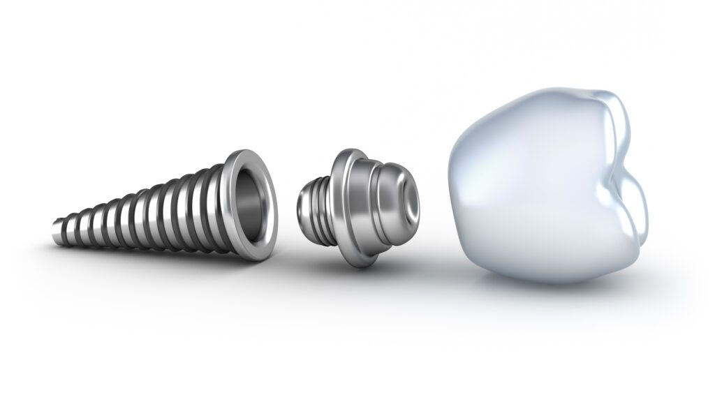 dental implant process in Hampstead, NC